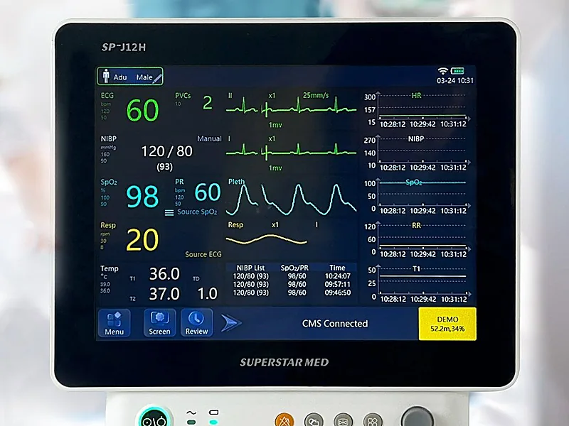 Patient Monitoring Equipment, diagnostic equipment supplied by Duara Group for the healthcare & medical sector